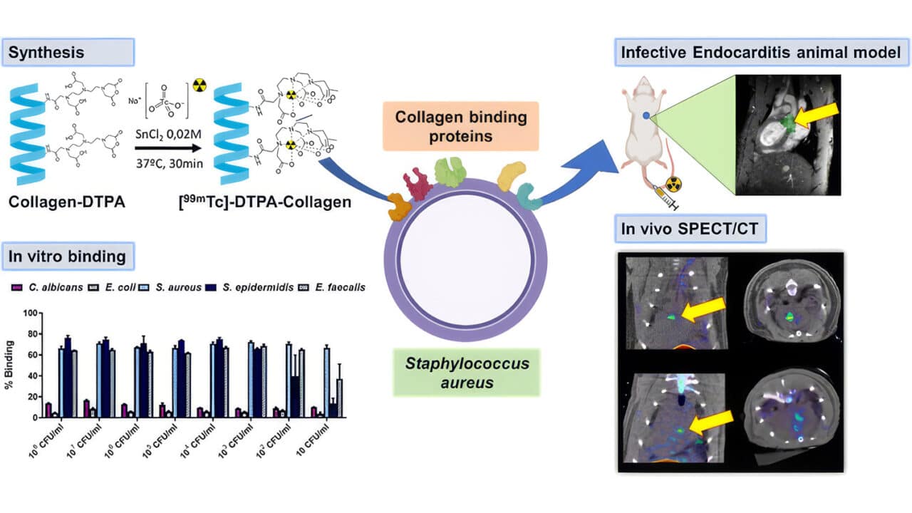 Infectious Diseases | MILabs